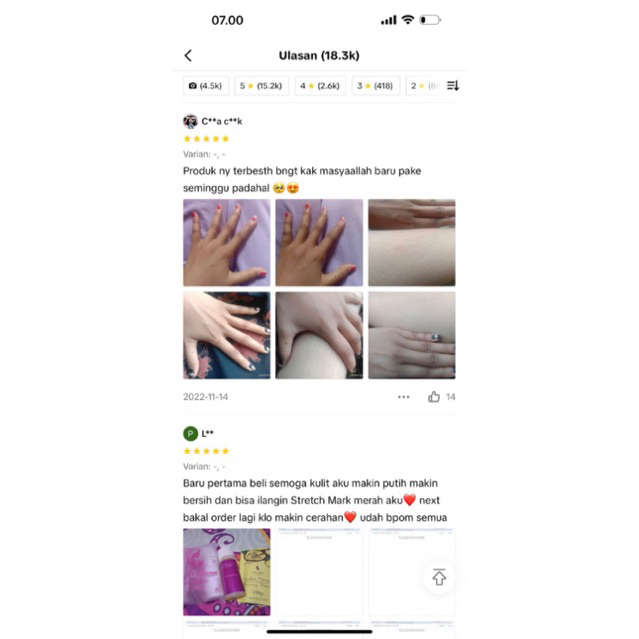 BPOM lotion hb dosting osyin glow racik pemutih badan ampuh penghilang bekas luka bibit pemutih anggur globe