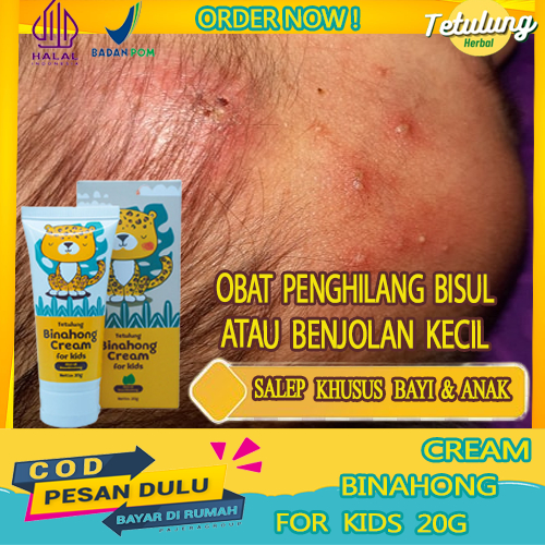 Cream Kids - Obat Bisul Ampuh dikepala Anak/Balita, Penghilang Benjolan Bernanah dikulit Kepala, Bis