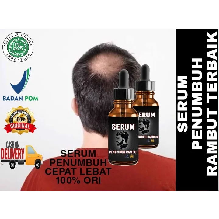 Penumbuh Rambut botak paling ampuh dan cepat