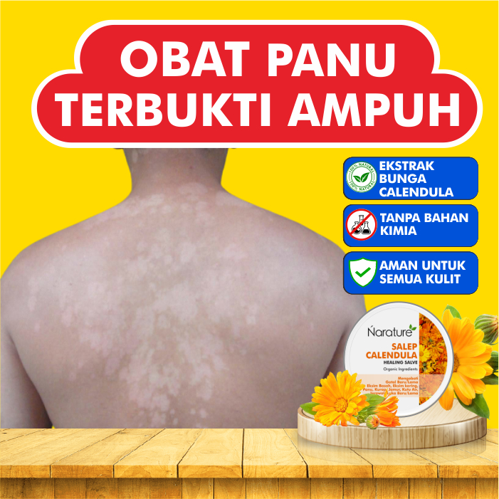 Obat Salep Panu Calendula Salve Anak dan Dewasa Ampuh Gatal Gatel Jamur Kulit  Kurap Kutu Air Jerawa