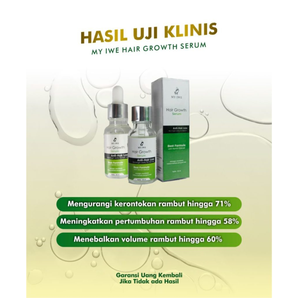 Serum My IWE Cegah Rambut Kebotakan - My IWE HAIR GROWTH SERUM