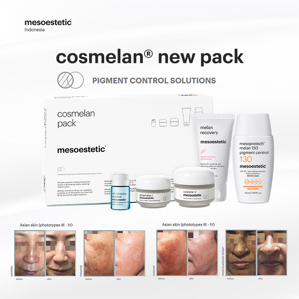 Mesoestetic Cosmelan Pack NEW - FREE POUCH DAN SAMPLE SACHET