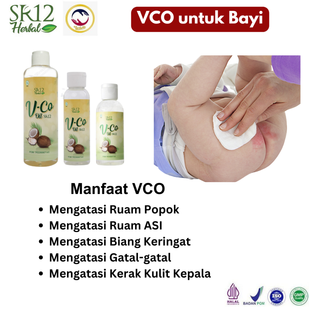 VCO SR12 Untuk Ruam Popok Minyak Bayi Biang Keringat Minyak Kelapa Untuk Bayi
