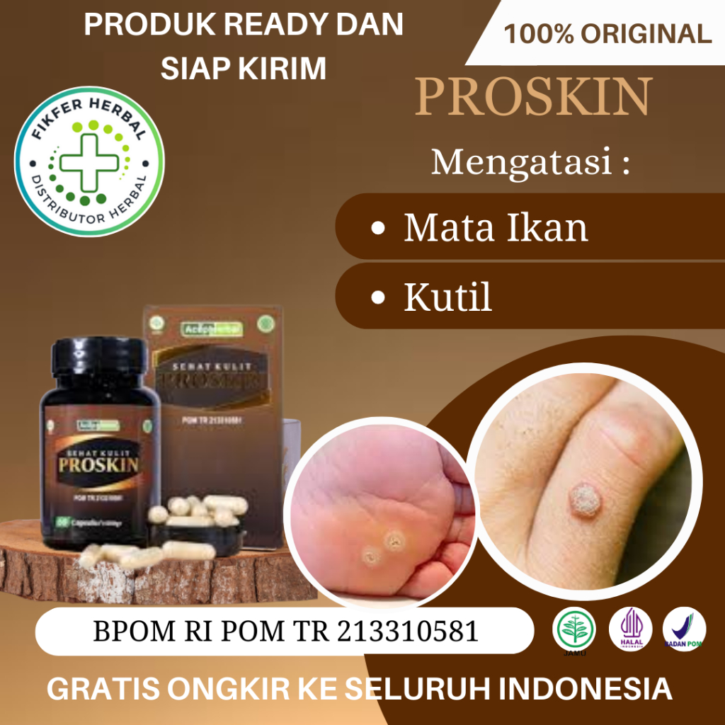 Obat Mata Ikan, Obat Kutil, Obat Pengecil Mata Ikan, Penghilang Mata Ikan, Obat Mata Ikan Di Telapak