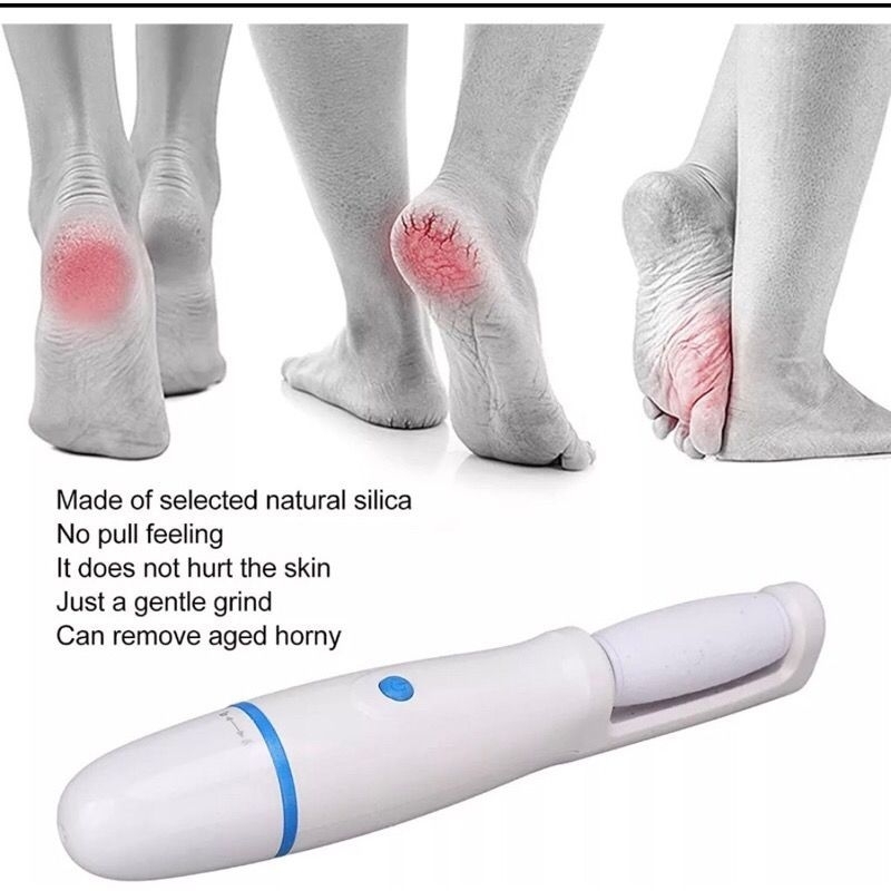 ￼Callous Remover NEW Find Back Foot Pedicure - Penghalus Kulit Kasar 00869