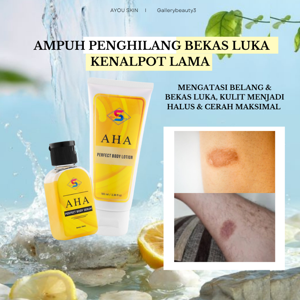 Cream Penghilang Bekas Luka Kenalpot, Krim Menghilangkan Bekas Luka Lama Di Kaki, Cream menghilangka
