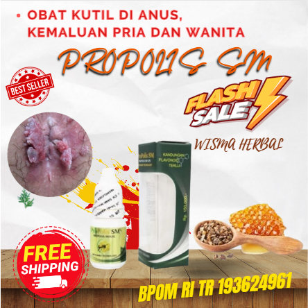 Obat Kutil Di Anus, Kemaluan Pria Dan Wanita, Obat Penghilang Kutil Buah Zakar, Prontok kutil herbal