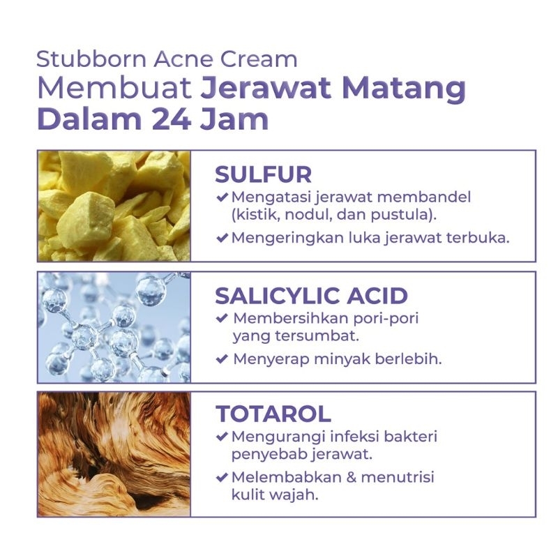 ACNAWAY Stubborn Acne Cream Krim Jerawat Acne Spot Treatment