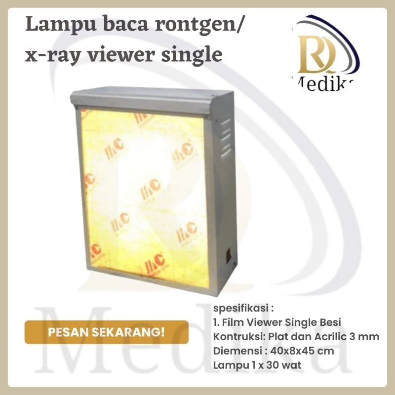 X-ray viewer single/x-ray/lampu baca rongten