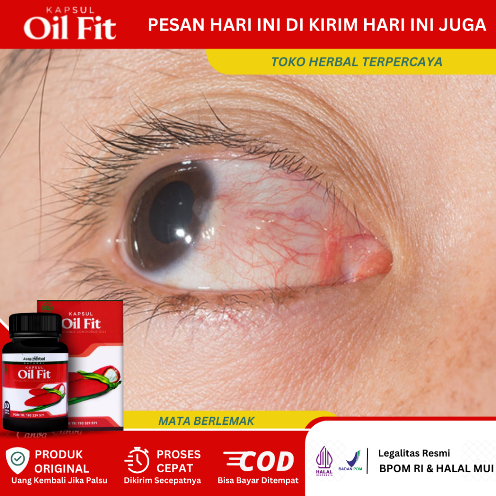 Obat Mata Berlemak, Obat Penghilang Mata Berlemak, Obat Selaput Putih Di Bola Mata, Obat Pembersih S