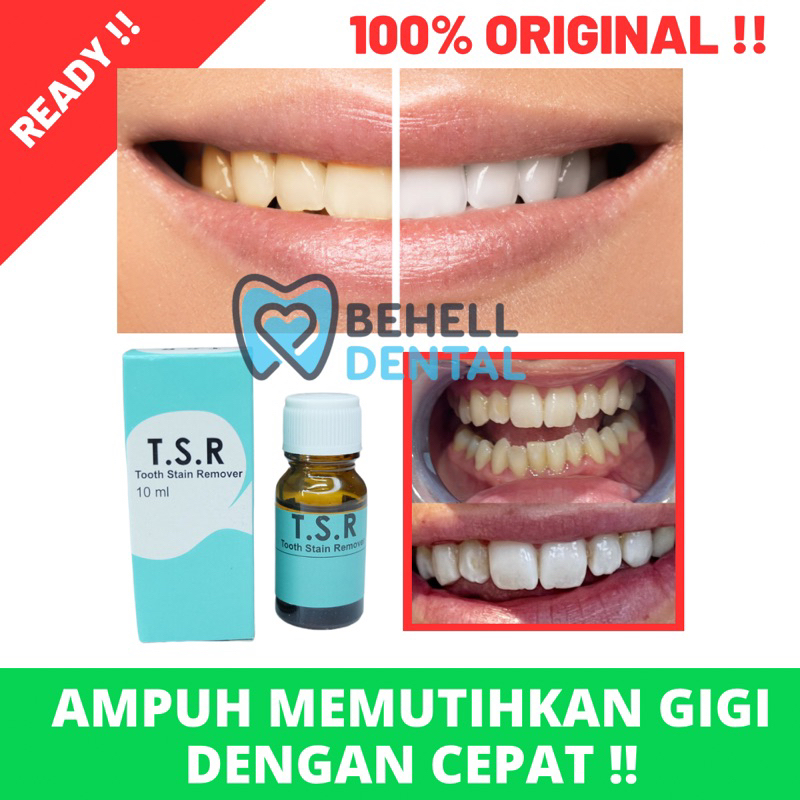 TSR ORI | PEMUTIH GIGI AMPUH PENGHILANG BAU MULUT PELUNAK KARANG GIGI BLEACHING WHITENING TEETH