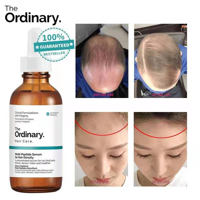 Hair Growth Serum Multi-peptide Serum The Ordinary Untuk Pria dan Wanita Obat Penumbuh Rambut Cepat Rambut Rontok Hair Growth Serum Hair Loss Treatment Botak Perawatan Rambut 60ml Hair Care