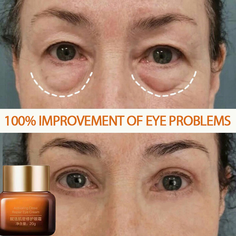 Eye Cream Activating Close Repair Eye Cream 20g Eye Bag Removal Dark Circles Anti-Wrinkle Anti-Aging Squalane / Asam Hyaluronic Activating Close Repair Eye Cream