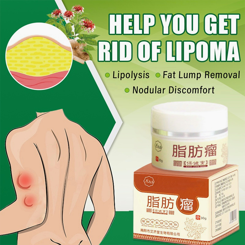【ORIGINAL】Obat benjolan obat lipoma obat benjolan di leher 30g salep benjolan Obat Benjolan lipoma obat benjolan payudara Meredakan Benjolan Lipoma Luar Lemak Menghilangkan Tonjolan Benjolan Padat 100% asli