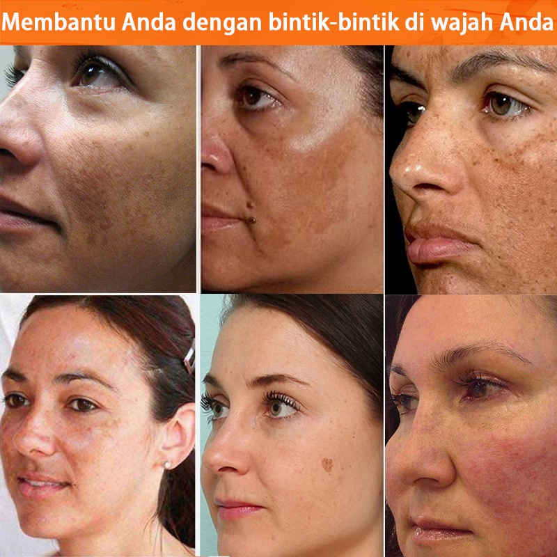 Krim pemutih wajah Crem pemutih wajah Face cream Vitamin C Whitening Krim Wajah Bintik-bintik Gelap Krim Wajah Perbaikan Memudar Bintik-bintik Melanin Remover