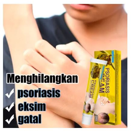 SALEP GATAL SALEP PSORIASIS, ECZEMA, DERMATITIS SOUTHMOON PSORIASIS CREAM