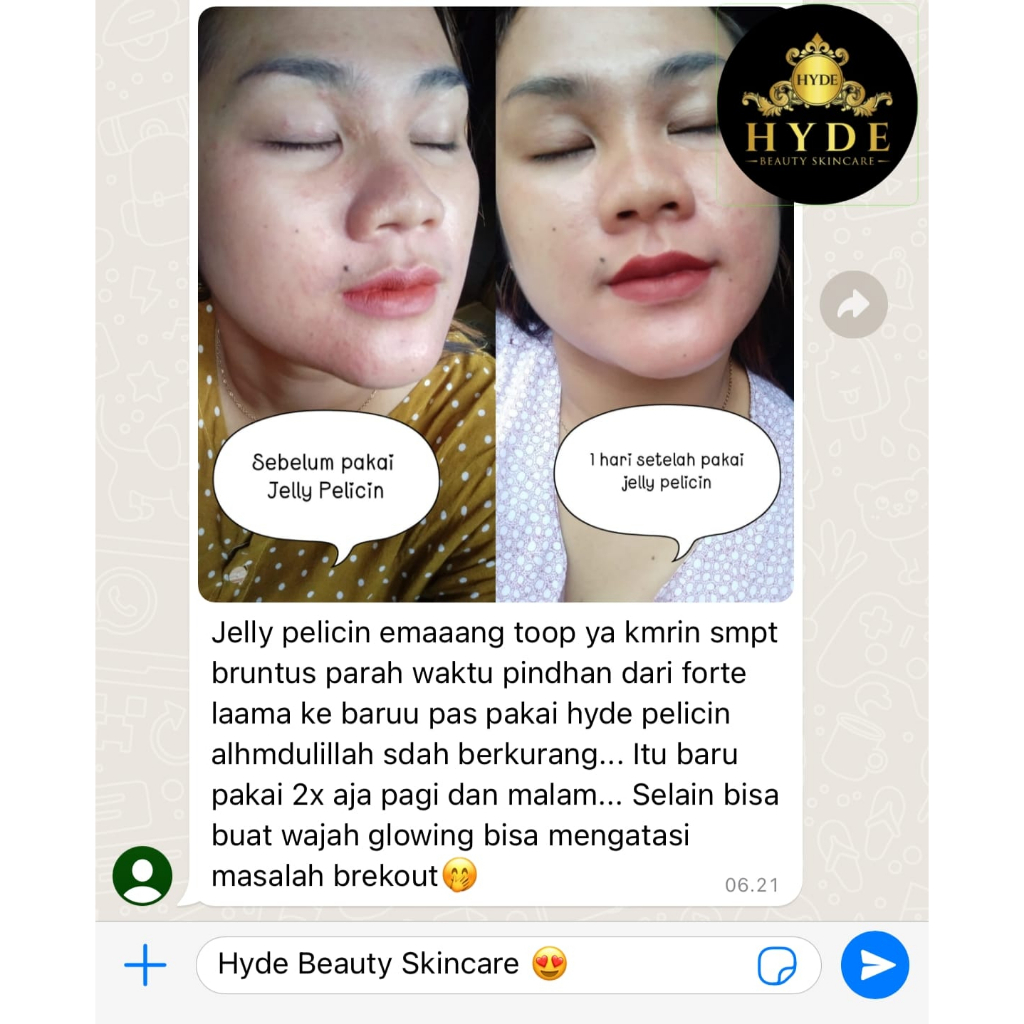 [BPOM] Jelly Extra Pelicin Hyde Semua Jenis Kulit | Jelly Booster Kinclong Moisturizer