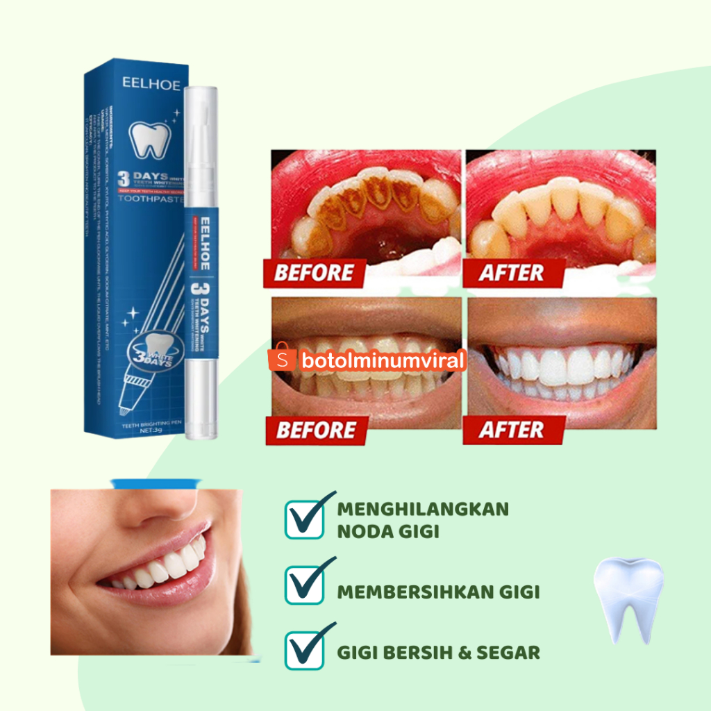 Teeth Whitening Pen Mencerahkan Pemutih Gigi 3 Hari Ampuh Original