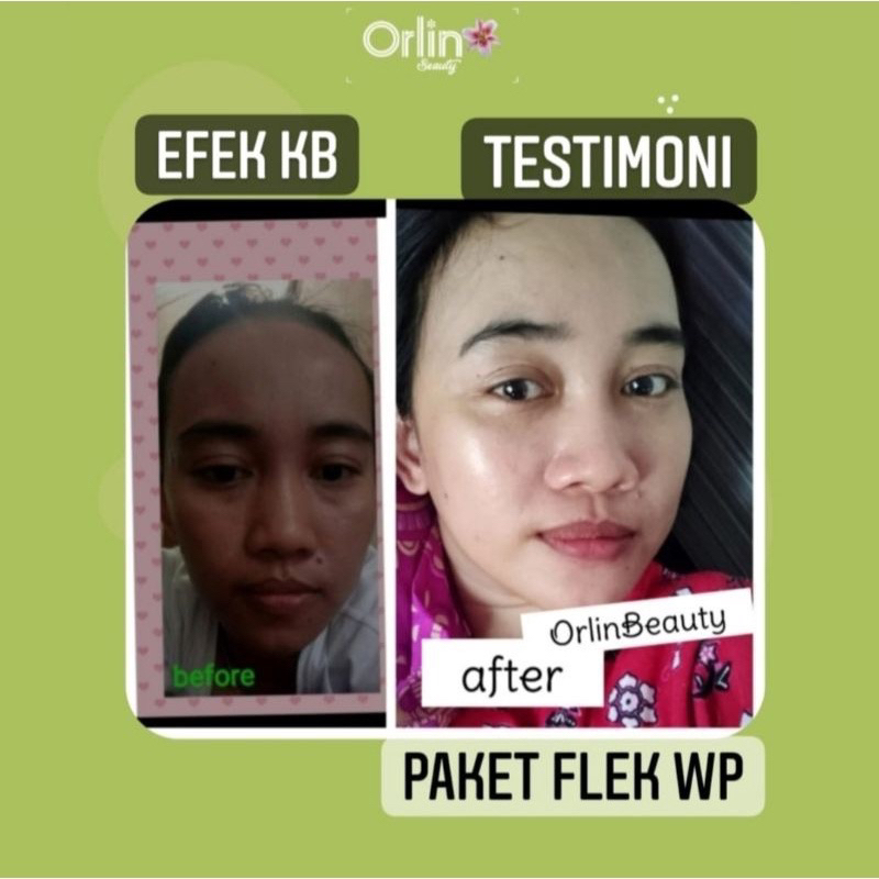 TERLARIS ! SERUM FLEK ORLIN / SERUM GLOW EXTRA ORLIN BEAUTY / SERUM FLEK / SERUM ANTI AGING ORLIN BEAUTY / MEMUDARKAN FLEK TEBAL DAN MEMUDARKAN BEKAS JERAWAT / ORLIN BEAUTY SKINCARE