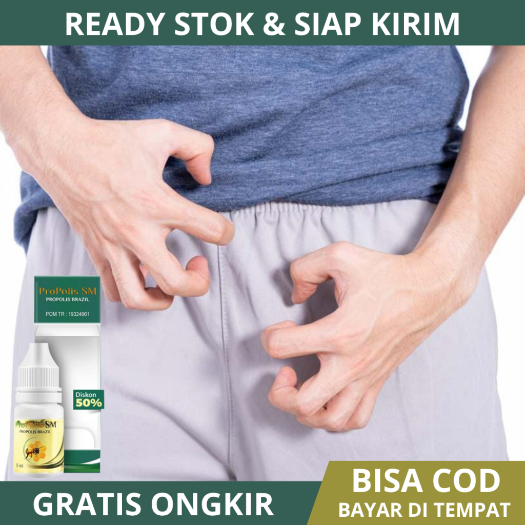 Obat Gatal Selangkangan Pria Wanita, Obat Infeksi Jamur Selangkangan, Obat Selangkangan Hitam, Obat 