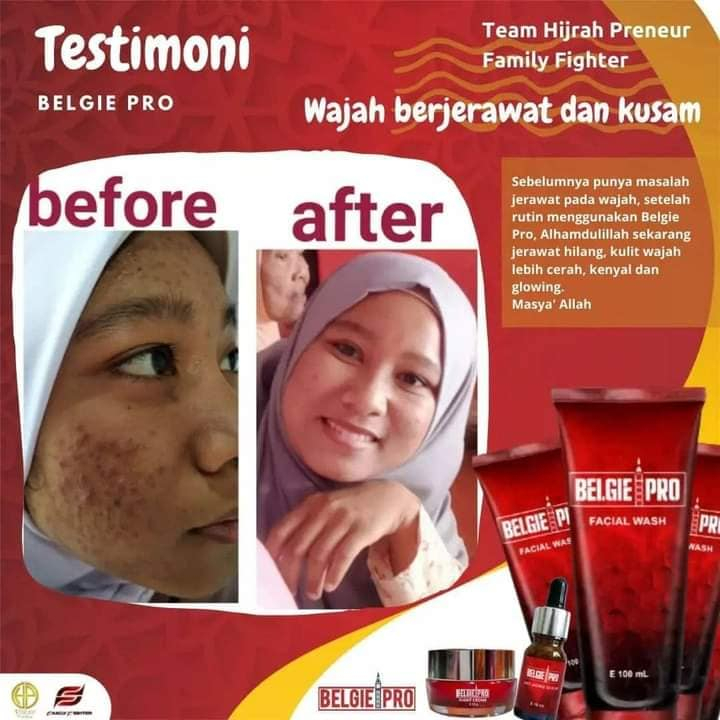 PAKET LENGKAP BELGIE PRO SERUM WASH NIGHT CREAM DAY CREAM ORIGINAL