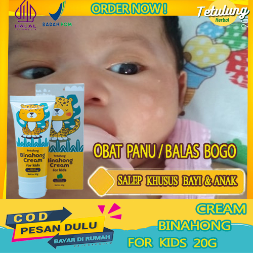 Cream Obat Panu Anak Obat Penghilang Balas Bogo, Salep Panu Bercak Putih Cream Binahong for Kids Oba