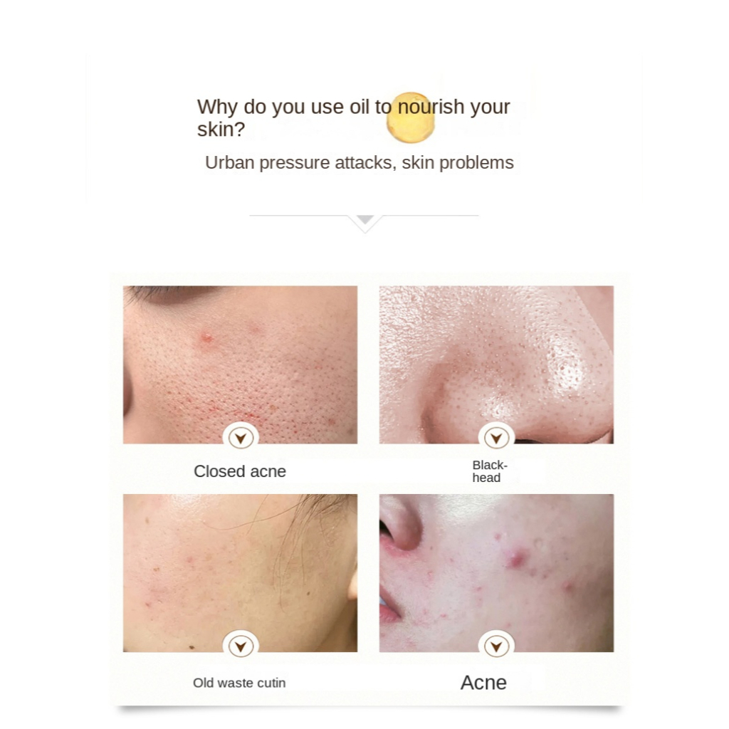 30ml Orchid Essence Oil Whitening And Freckle Removal Time Condensation Oil Moisturiz Orchid Hydrating Oil Dissolving Essence