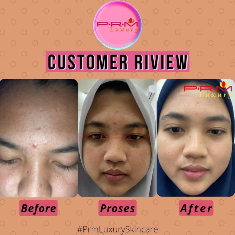 SKINCARE PRM LUXURY GLOW,ACNE,FLEK ✨  AMAN BUMIL BUSUI BPOM ✅ FREE POUCH