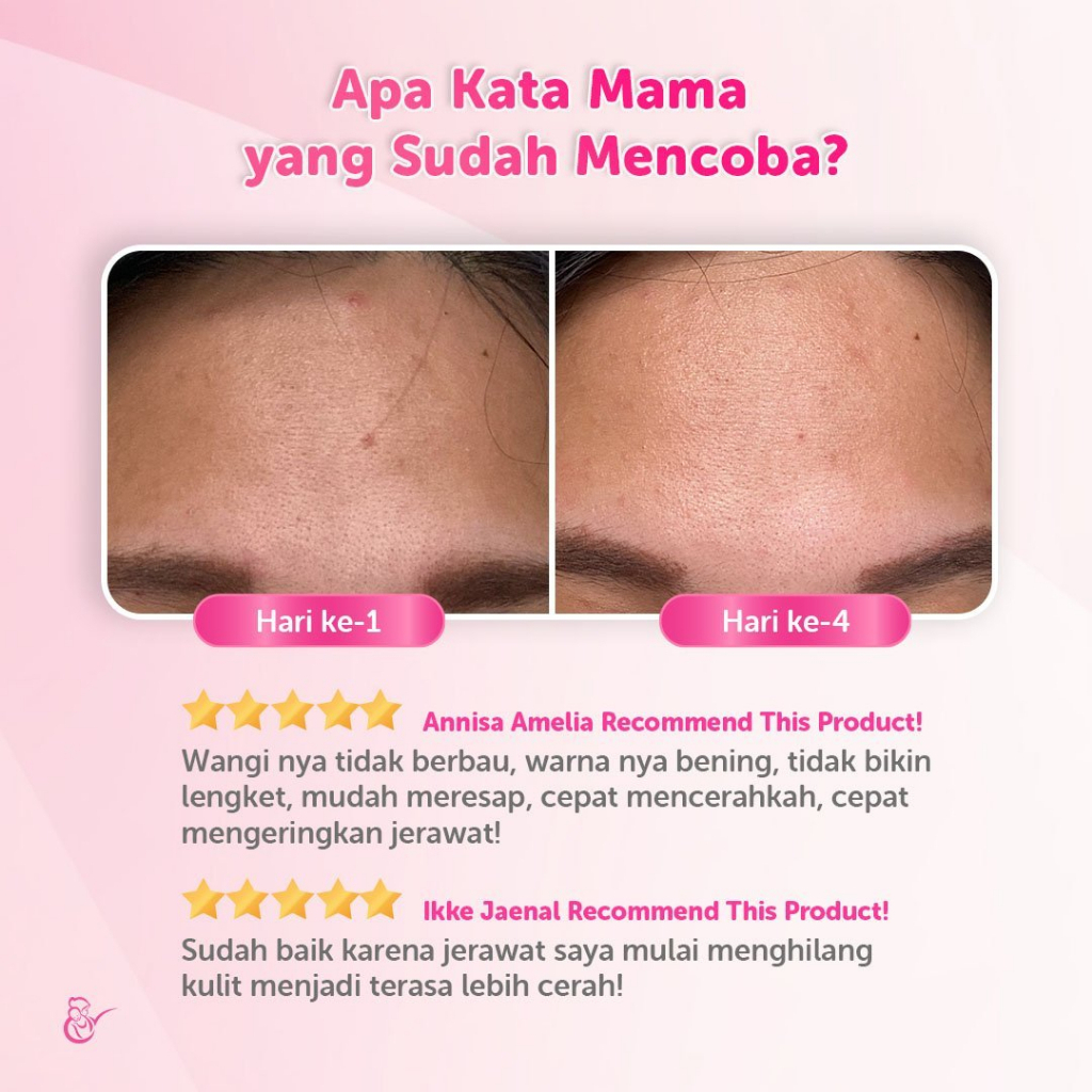 Mama's Choice Anti Acne Serum 30ml / Mama Choice Serum Anti Jerawat 30 ml / Skincare Ibu Hamil Serum Jerawat / Skin care Jerawat Ibu Hamil