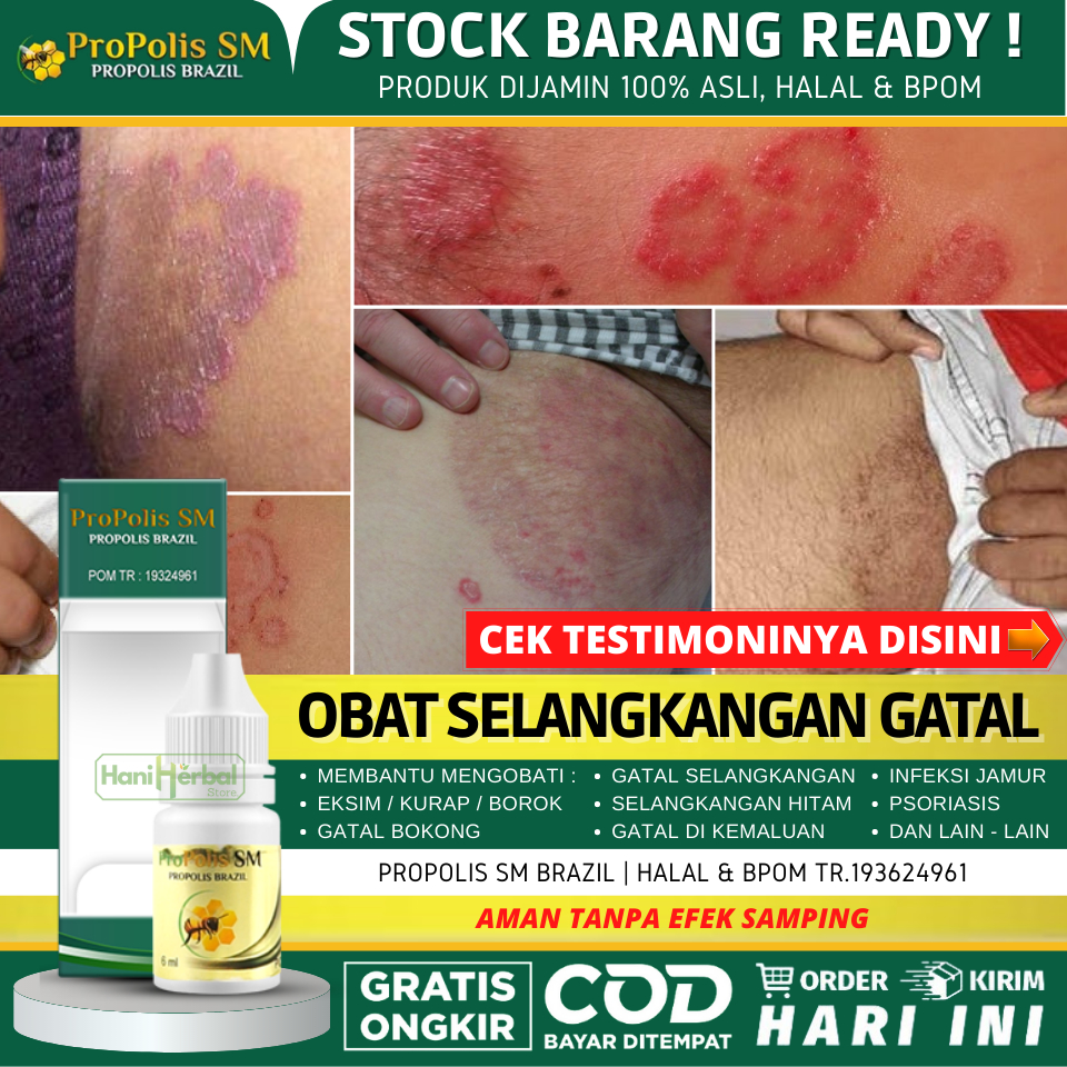 Obat Penghilang Gatal di Selangkangan 100% Alami, Obat Gatel di Pantat, Obat Gatal Gatal di Kemaluan