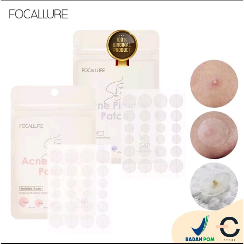 FOCALLURE Spot Patch Acne treatment Day/Night FA-186 BPOM Berkualitas