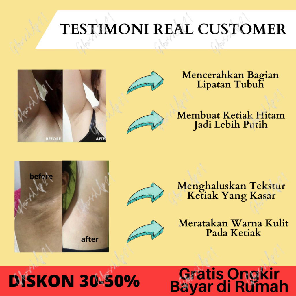 CREAM PEMUTIH KETIAK ORI - EVER WHITE AXILLARY CREAM 15GR ORIGINAL