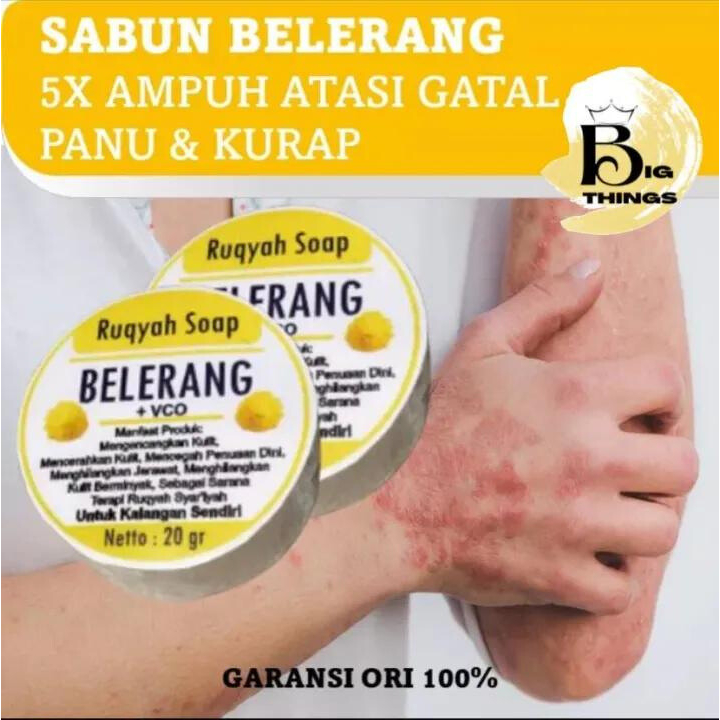 Sabun Belerang Mengobati Kulit Gatal Jerawat Panu Gatel Selangkangan Eksim dan Mengangkat sel Kulitt Mati VCO Spirulina Ruqyah 20gr Plus 100% Original