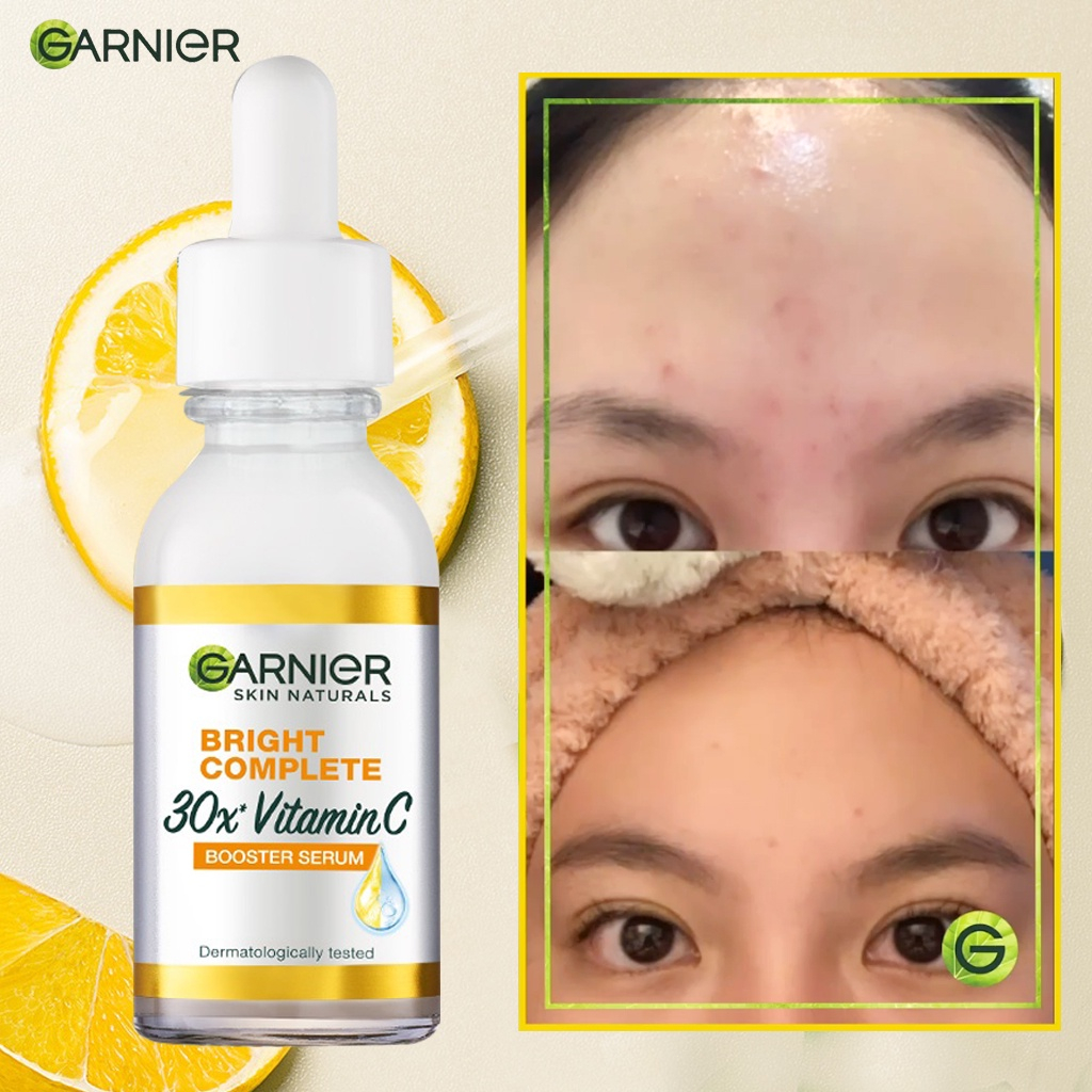 Garnier Bright Complete Vitamin C 30x Booster Serum Skin Care - 30ml Cepat Cerahkan Noda Hitam &amp; Samarkan Bekas Jerawat