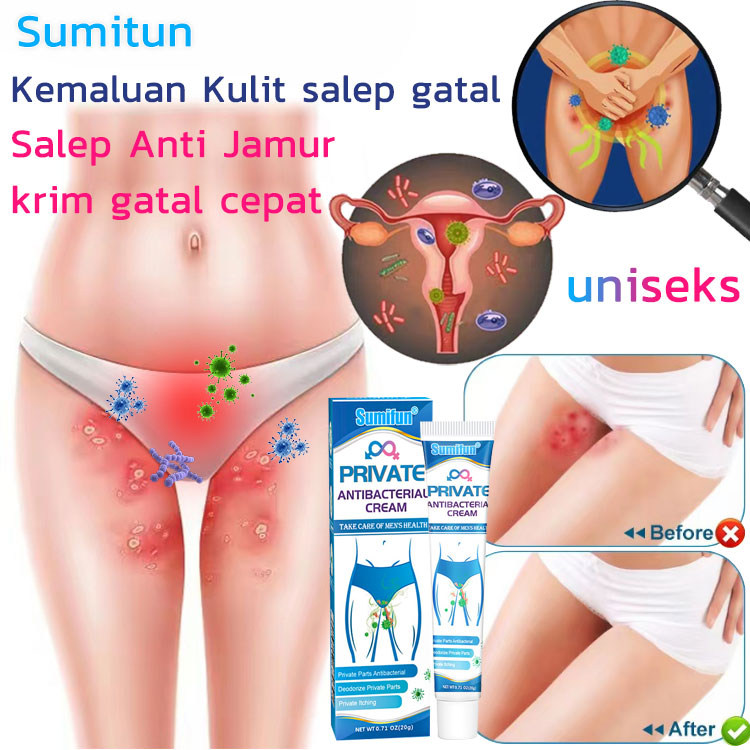 【ORIGINAL】Kemaluan Kulit salep gatal , Kulit Itchy Salep Anti Jamur , Obat Gatal Selangkangan gatal 