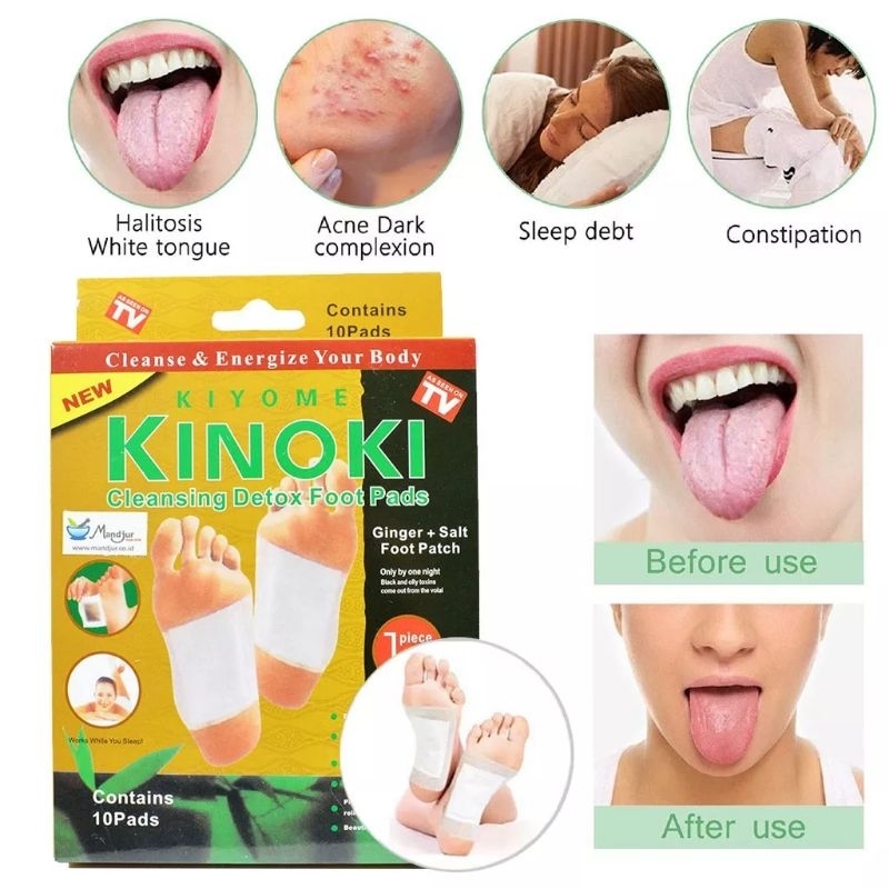 kinoki koyo Detox Toksin 10pcs Gold original kaki emas herbal buang racun