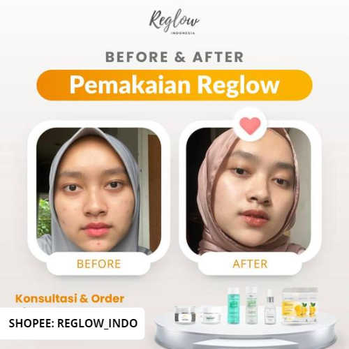 PROMO PAYDAY Reglow Paket Lengkap + Serum dr Shindy Skincare Best Combo