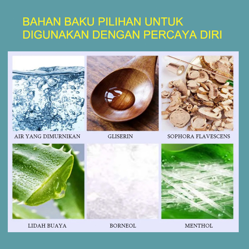 Obat Gatal Salep Obat Gatal Kulit Krim Gatal 20ml Salep antibiotik psoriasis antibakteri gatal krim krim dermatitis dan psoriasis psoriasis eksim eksim antid gatal salep