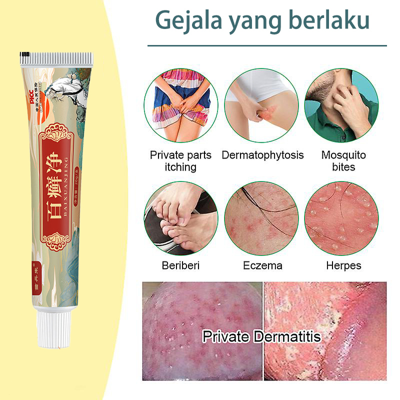 Obat Gatal Salep Obat Gatal Kulit Krim Gatal 20ml Salep antibiotik psoriasis antibakteri gatal krim krim dermatitis dan psoriasis psoriasis eksim eksim antid gatal salep