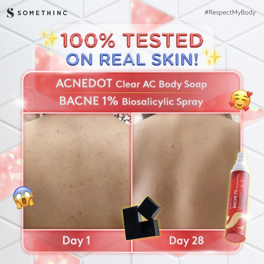 ✨ AKU MURAH ✨ SOMETHINC Acnedot Clear AC Body Soap