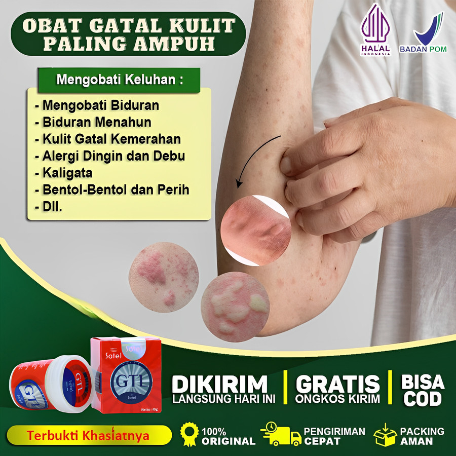 Salep Obat Gatal Gatel Gatal2 Kemaluan Selangkangan Eksim dan Jamur Paling Ampuh Untuk Kulit