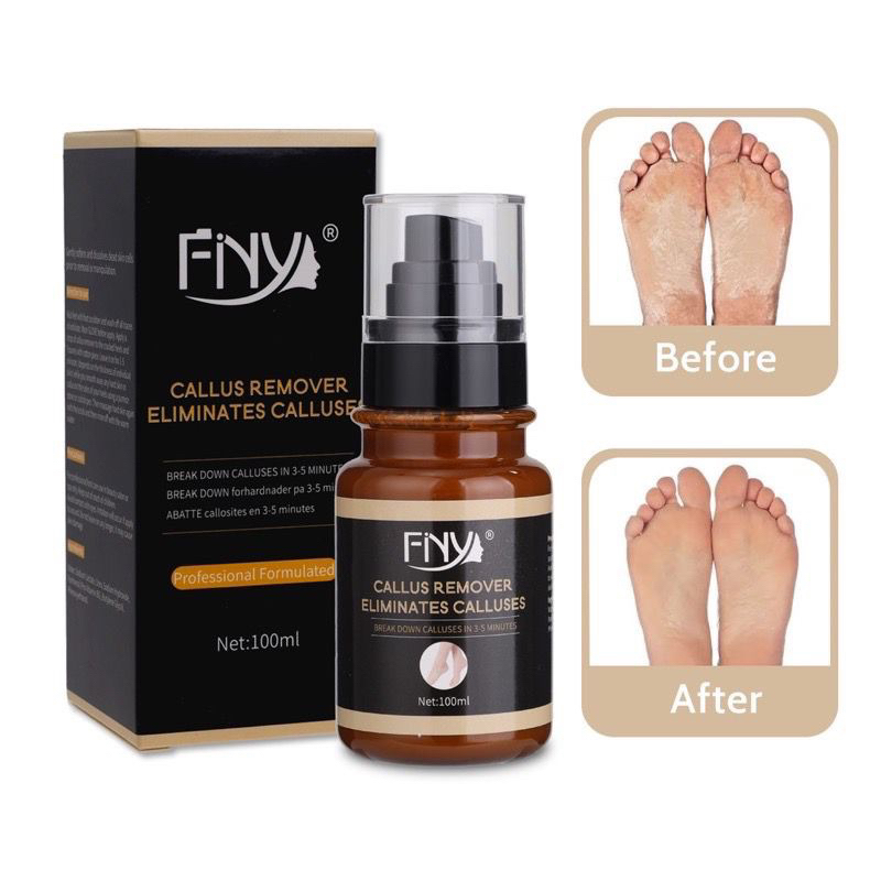 FINY CALLUS REMOVER PROFESSIONAL 100ml