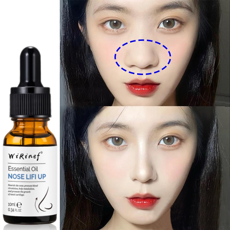 WiRinef Alat Nose lift Up Minyak Hidung 10ml  Alat Pemancung Hidung dan Pengurangan Hidung Hasil Alami Permanen dan Aman Nose lift Up Essential Oil (Free Nose Up  Clipper)