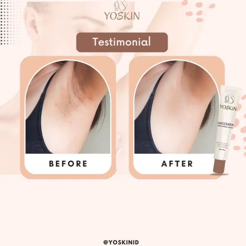 YOSKIN GLOWING UNDERARM PEMUTIH KETIAK SELANGKANGAN BOKONG