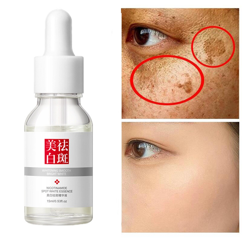 Nicotinamide Whitening Serum Freckles Remove Dark Spots SERUM ANTI AGING ORIGINAL | SERUM ANTI PENUAAN VIRAL