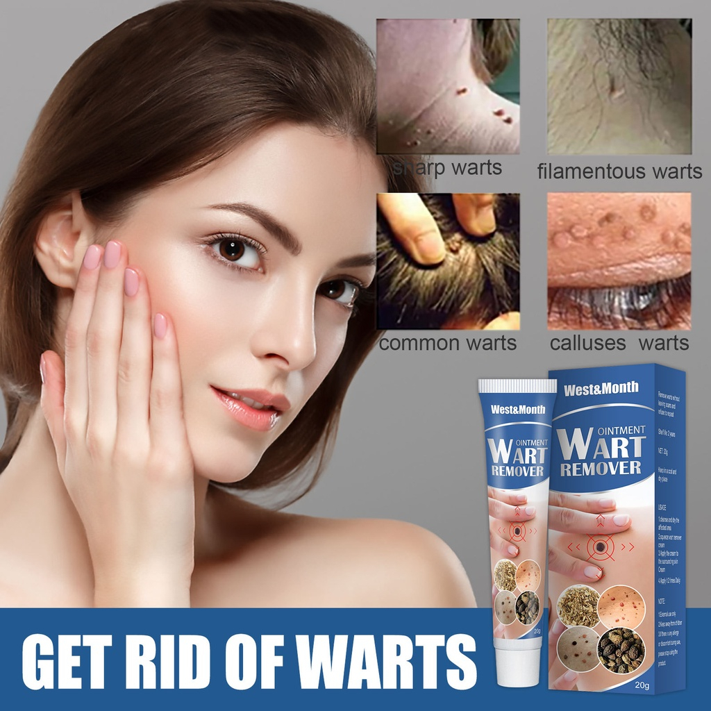 Krim Kutil Warts Remover Cream Wart Treatment Skin Tags Mole Remover Plaster Cream Antibacterial Foo