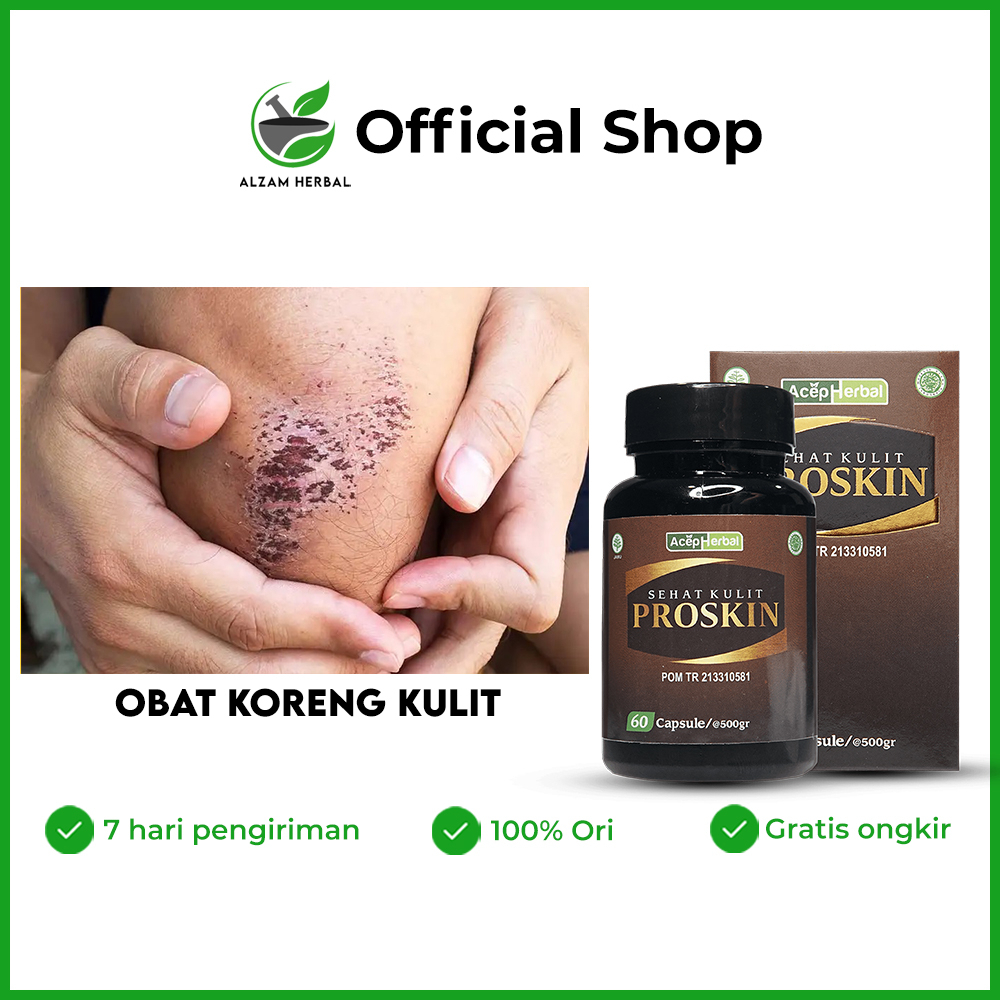 Alzam Herbs - Obat Koreng Di Kaki, Koreng Bernanah, Bekas Luka, Gatal Gatal Korengan, Menghilangkan 