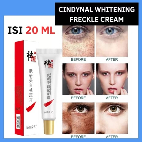 CINDYNAL Whitening Freckle Cream Penghilang Flek Noda Hitam Wajah Bersih dan Cerah