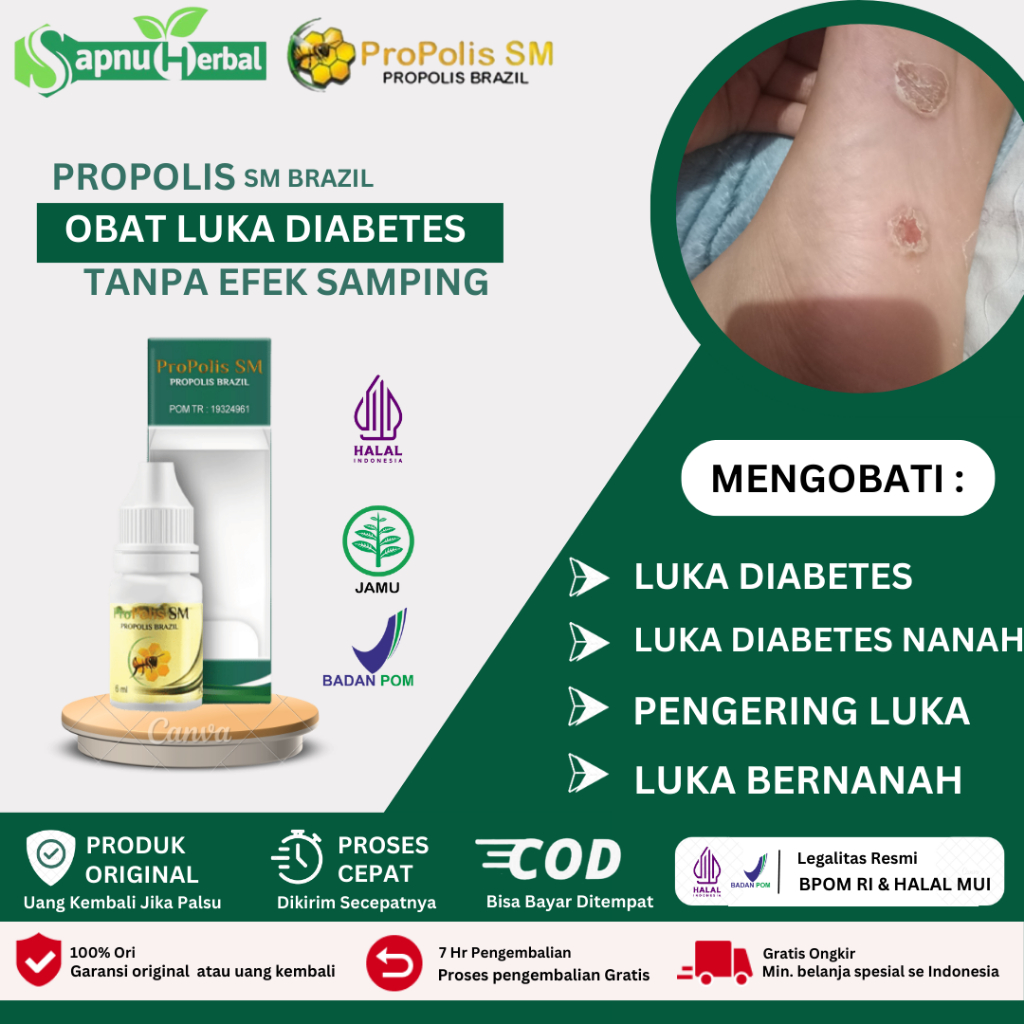 Obat Luka Diabetes, Obat Luka Diabetes Basah Agar Cepat Kering, Obat Luka Diabetes Bernanah, Obat Pe