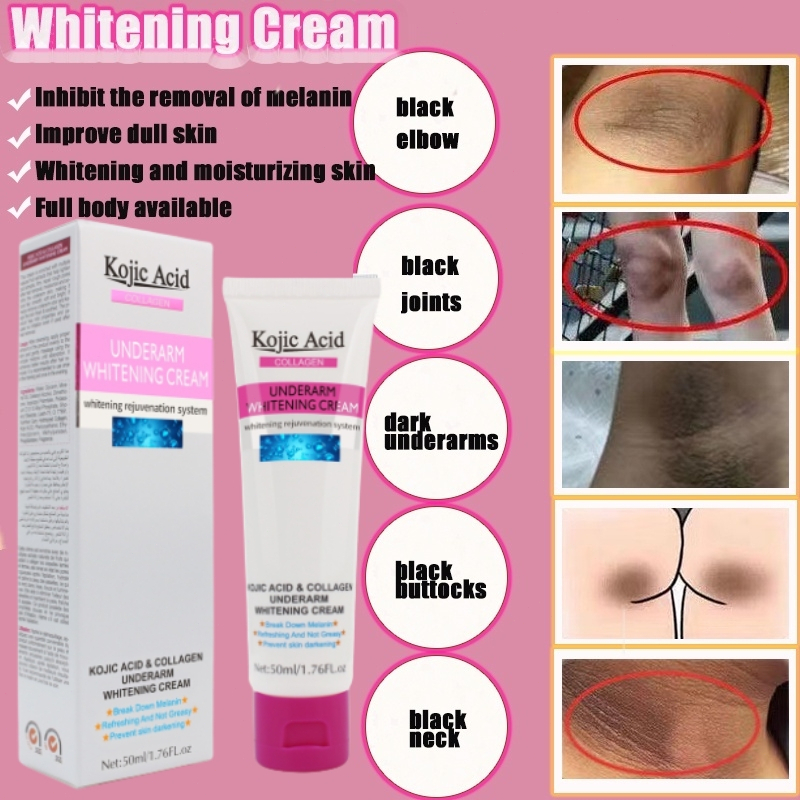 Kojic Acid Collagen Underarm Whitening Cream 50ml Krim Pemutih Ketiak dan Selangkangan Hitam| Pemutih Kulit dan menghilangkan bau badan-50ml Original